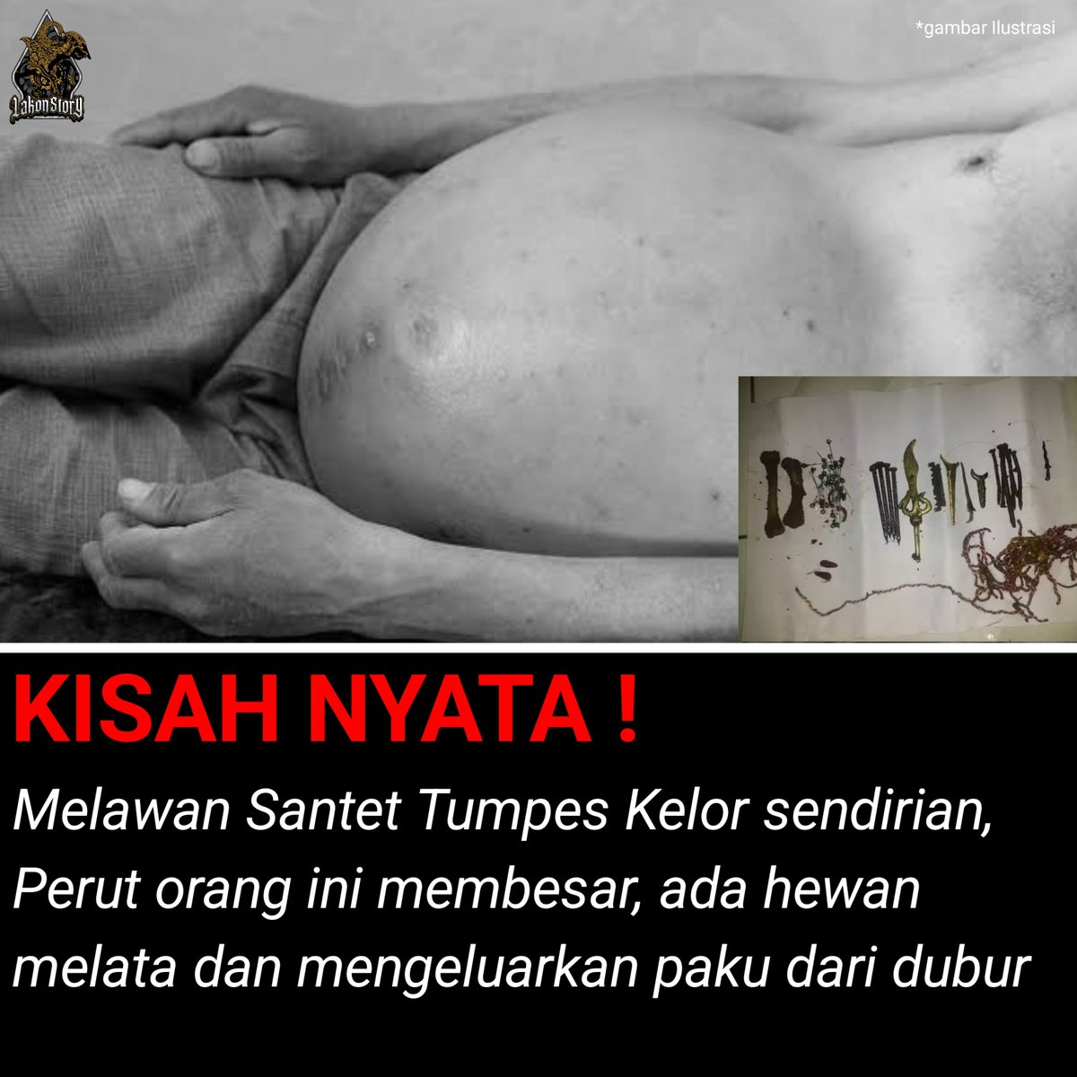 Lakonstory's tweet photo. KISAH NYATA !.

Akibat melawan santet tumpes kelor, perut orang ini malah membesar, setiap hari mengeluarkan paku dudur hingga Muntah darah.

A Thread. https://t.co/RxWkfKsjIe