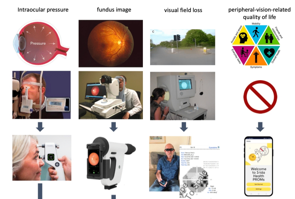 🚨An exciting opportunity for an early-stage researcher or a research-optometrist/ophthalmologist 
jobs.ac.uk/job/DMM379/pos…
Brilliant @DunhillMedical project led by brilliant Pete Jones
