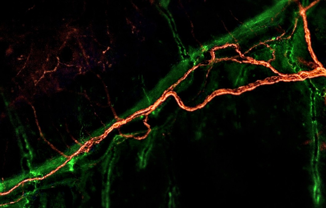 Mohamed G. Hassan (@hassanmge) on Twitter photo #FluorescenceFriday a 1 µm nerve fiber weaving along the coronal suture of the calvaria. Appreciating the hidden neurovascular intricacies of bone healing, one frame at a time.
#craniofacial #Bone #Microscopy #Neuroscience #FluorescenceFriday a 1 µm nerve fiber weaving along the coronal suture of the calvaria. Appreciating the hidden neurovascular intricacies of bone healing, one frame at a time.
#craniofacial #Bone #Microscopy #Neuroscience