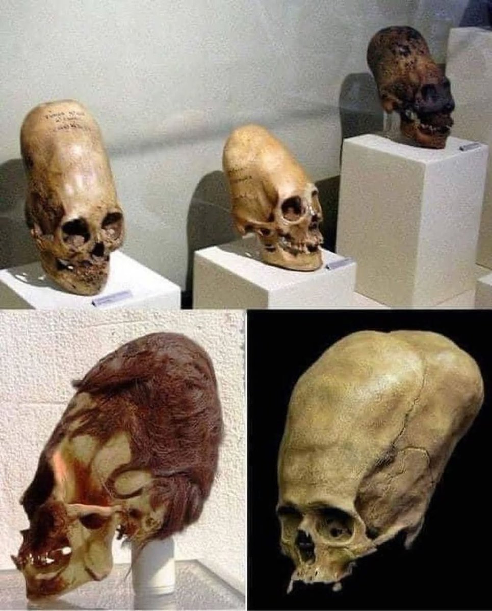 archeohistories's tweet image. In 1928, a Peruvian archaeologist made a remarkable discovery on the south coast of Peru, in the Paracas Desert Peninsula. The excavation unearthed a number of elongated skulls, which quickly captured the attention of researchers and sparked debates about their origins and…