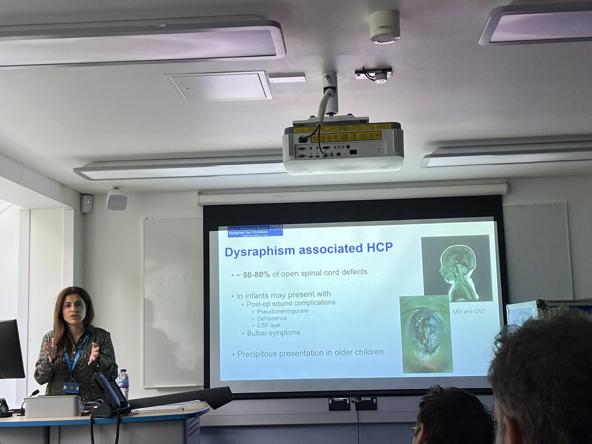 Queen Square Simulation Centre (@qs_simcentre) on Twitter photo It was a pleasure to hear from Ms Figueroa, discussing perspectives on paediatric hydrocephalus from Great Ormond Street!
<a href="/drkanzatariq/">Kanza Tariq</a>
<a href="/EmaleeBurrows/">Emalee Burrows</a> It was a pleasure to hear from Ms Figueroa, discussing perspectives on paediatric hydrocephalus from Great Ormond Street!
<a href="/drkanzatariq/">Kanza Tariq</a>
<a href="/EmaleeBurrows/">Emalee Burrows</a>