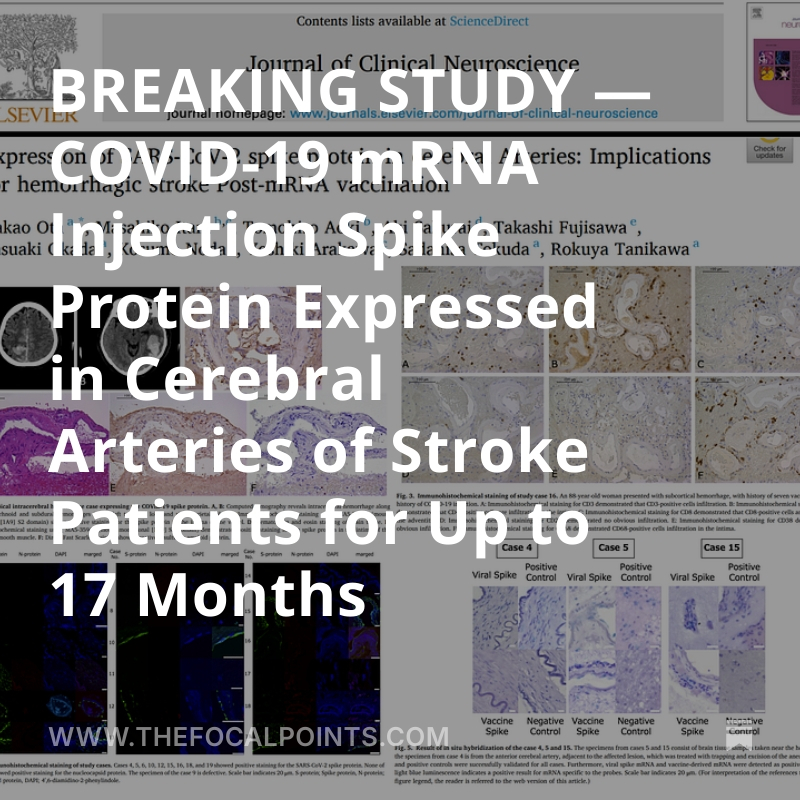 BREAKING— COVID-19 mRNA Injection Spike Protein Expressed in Cerebral Arteries of Stroke Patients for Up to 17 Months

Vaccine mRNA and Spike protein found in hemorrhagic stroke patients' brains — confirming human biodistribution to vital organs.  Spike protein expression was