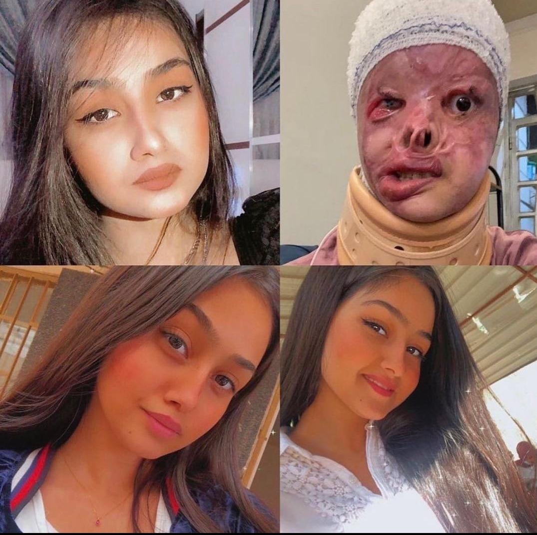 L'any 2021  la jove iraquiana Maryam Al-Rikabi, de 20 anys i estudiant d’art, va rebutjar una proposta de matrimoni, davant del que l’home va respondre abocant-li àcid a la cara mentre dormia. El jutge va simpatitzar amb l’agressor i va acusar la família de la noia de ser una