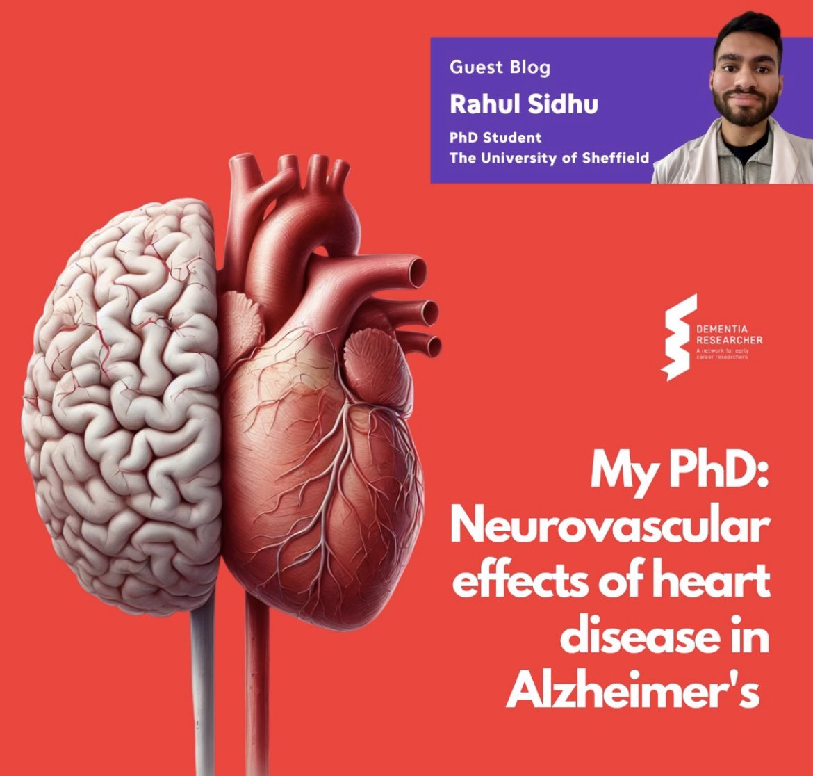 Rahul Sidhu (@rahulsidhu_) on Twitter photo I have recorded my first podcast and blog for <a href="/demrescommunity/">Dementia Researcher</a> about my PhD research on how heart disease affects #dementia.
DID YOU KNOW? Your brain has 400 miles of blood vessels, and these help fuel the brain! Listen to learn more…
Spotify: open.spotify.com/episode/0X9Svq… I have recorded my first podcast and blog for <a href="/demrescommunity/">Dementia Researcher</a> about my PhD research on how heart disease affects #dementia.
DID YOU KNOW? Your brain has 400 miles of blood vessels, and these help fuel the brain! Listen to learn more…
Spotify: open.spotify.com/episode/0X9Svq…