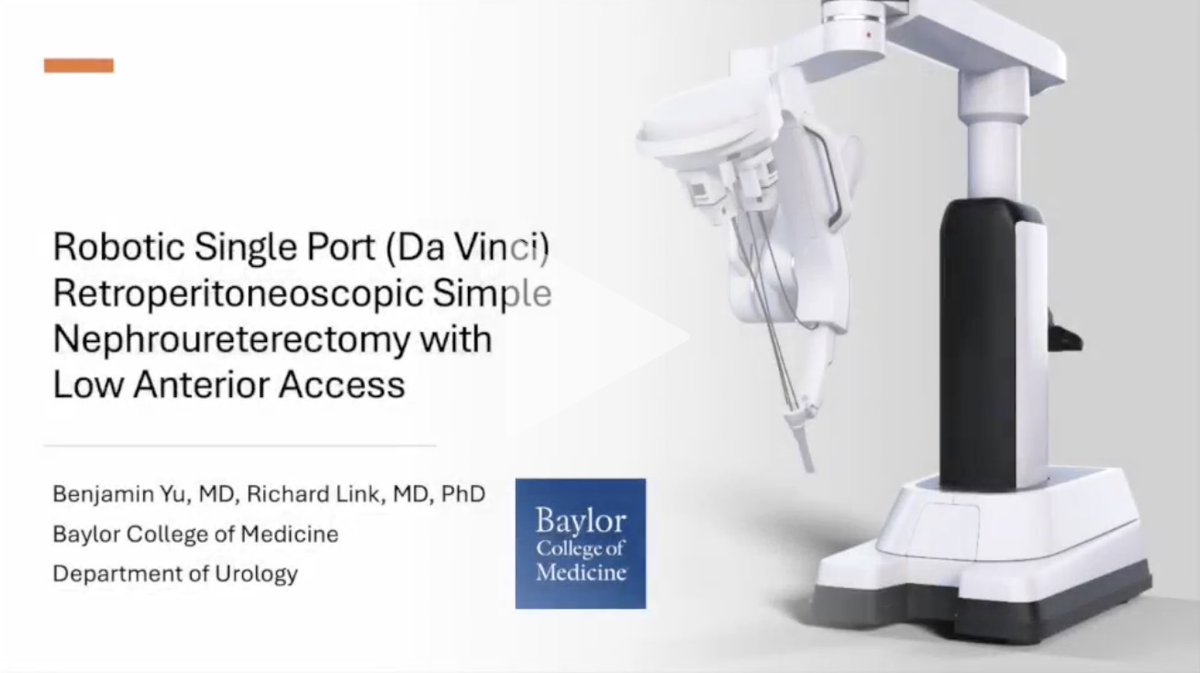 Richard Link (@robodocx) on Twitter photo Da Vinci SP regionalized surgery through low anterior access can be particularly valuable for nephroureterectomy. Here's an example of a simple nephroureterectomy published in <a href="/urovidjournal/">Urology Video Journal (UVJ)</a> with tips and tricks and suggestions for patient selection. doi.org/10.1016/j.urol… Da Vinci SP regionalized surgery through low anterior access can be particularly valuable for nephroureterectomy. Here's an example of a simple nephroureterectomy published in <a href="/urovidjournal/">Urology Video Journal (UVJ)</a> with tips and tricks and suggestions for patient selection. doi.org/10.1016/j.urol…