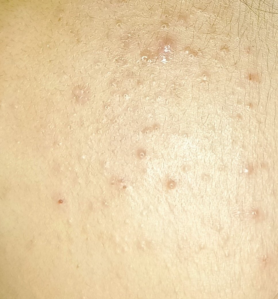 raa #OdeToLove 🤍 tweet media