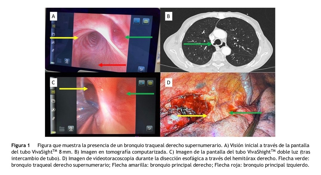 Revista Española de Anestesiología y Reanimación tweet media