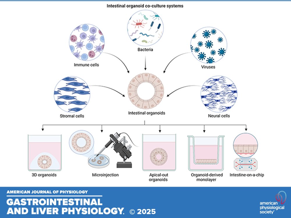 ajpgi's tweet photo. New review in @ajpgi "Intestinal organoid coculture systems: current approaches, challenges, and future directions" by Ghanyah Al-Qadami et al.

🖱️https://t.co/tsEW8EMmrS

#IntestinalOrganoids #Microbes #ImmuneCells #StromalCells https://t.co/QgDrBcj9HB