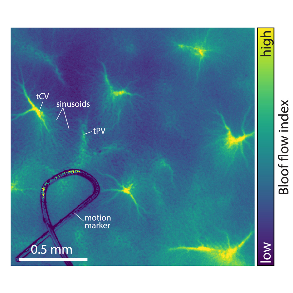 OpticaPubsGroup's tweet image. An Editors' Pick via #OPG_BOEx: Laser speckle contrast imaging of hepatic microcirculation bit.ly/42dYK1s #SpeckleImaging #WaveletTransforms @koebenhavns_uni