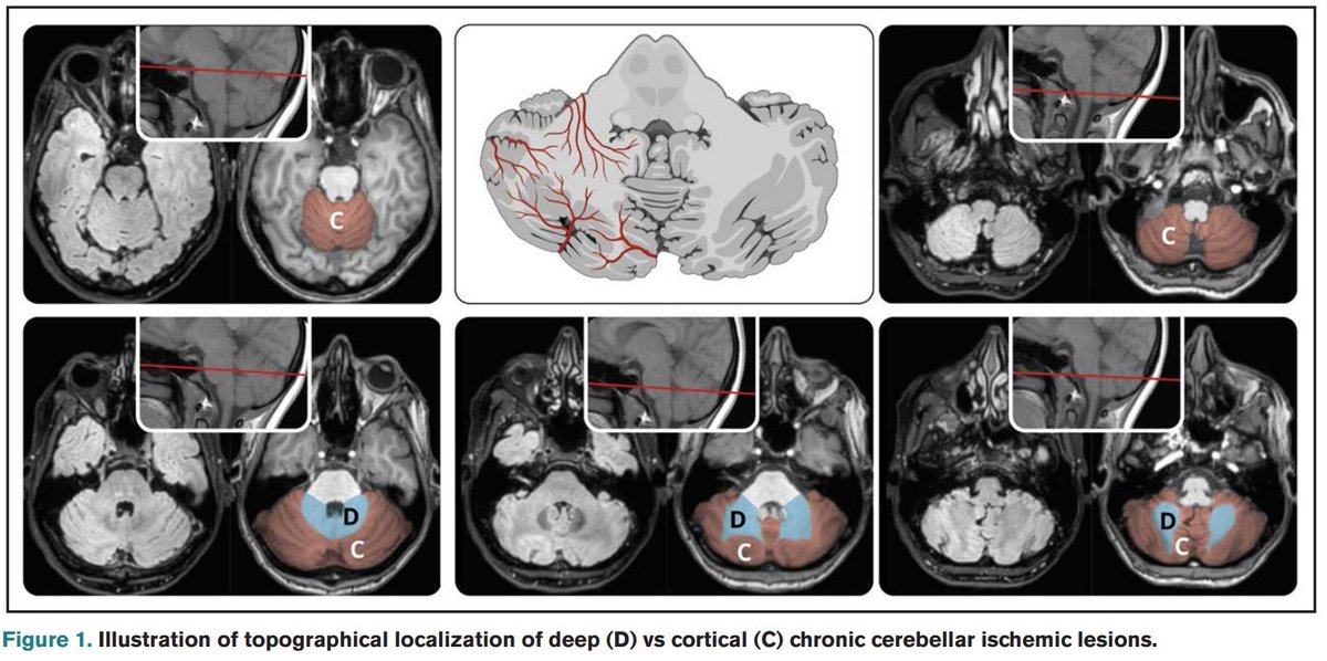 Stroke Research Center Bern tweet media