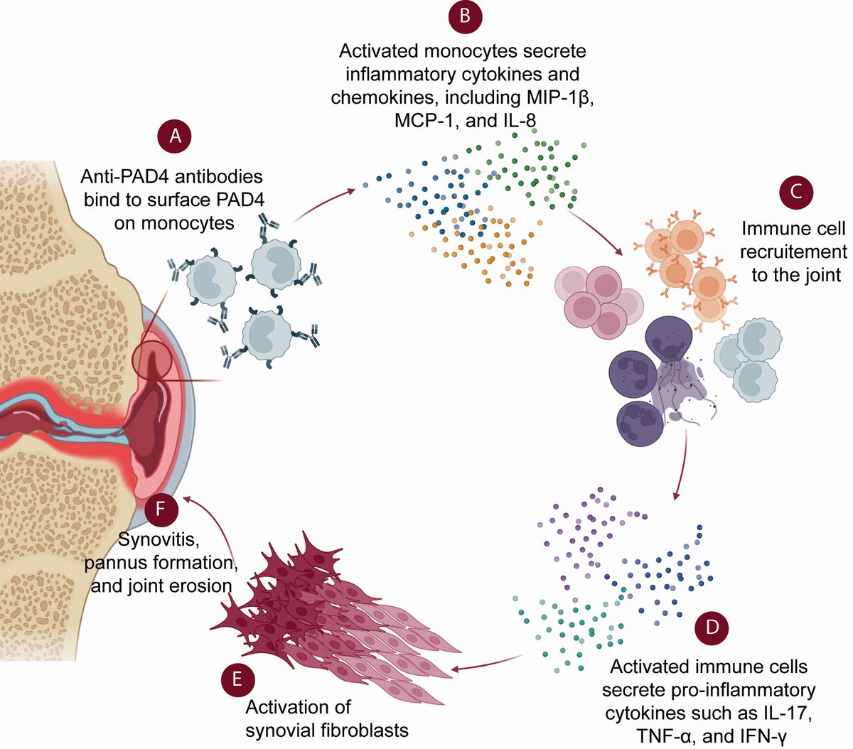 Proposed mechanism of rheumatoid arthritis disease exacerbation by anti-PAD4 antibodies