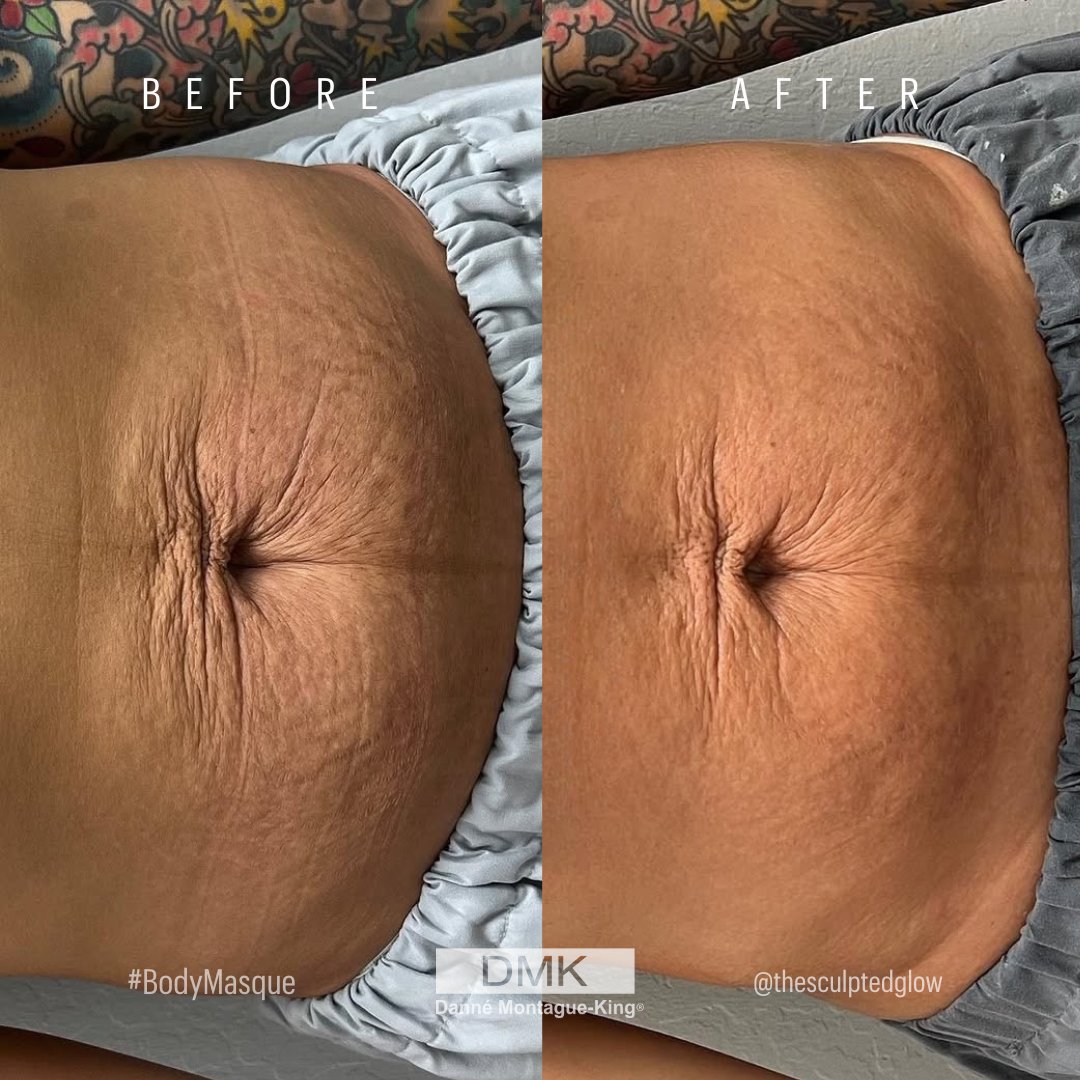 💚 DMK International | Professional Skincare 💚 tweet media