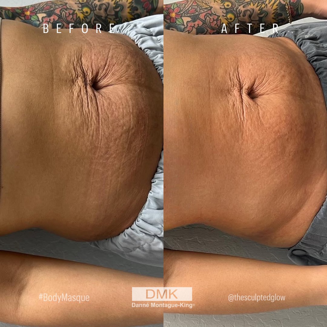 💚 DMK International | Professional Skincare 💚 tweet media