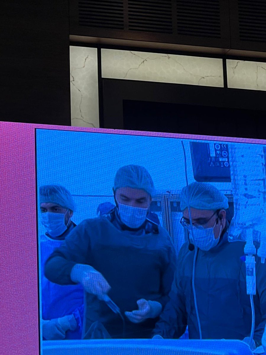 cagriyayla's tweet photo. TKD 32. Ulusal Uygulamalı Girişimsel Kardiyoloji Kongresinin 2.gününde Prof.Dr. Adnan Burak Akçay hocamız ile birlikte Ciddi Aort Darlığı olan bir hastaya Meril Octacor marka TAVİ kapağını canlı yayında başarılı bir şekilde implante ettik...@TKDsosyal https://t.co/kEnBTxF13s