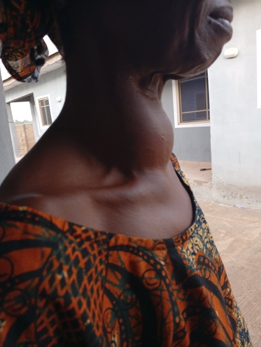 KrypticKareem's tweet image. God, please help me. I can't lose her just because I don’t have the money to save her. My heart won’t survive it. Please, don’t let this be the end.