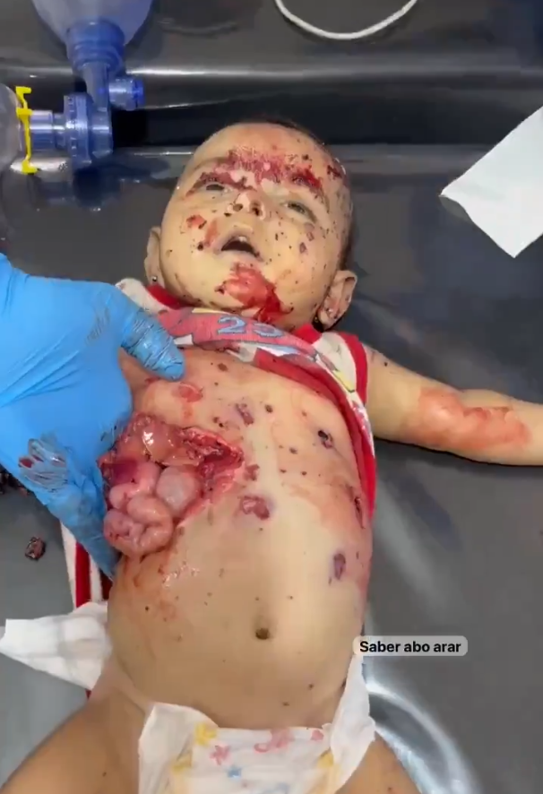 ✅ GAZZEDE SOYKIRIM DEVAM EDİYOR
✅ GAZZEDE AÇLIK DEVAM EDİYOR

✅ GAZZEYİ PAYLAŞMAKTAN ÇEKİNMEYİN
✅ KATİLE KİM DUR DİYECEK

#SONDAKİKA Boykot İstanbul Şaka  Ali Koç Okan İsrail Taksici Hükümet Türk Milleti Bitcoin Iran Turkey Bebek Video Viral Animal Dog Cat Cats War Messi