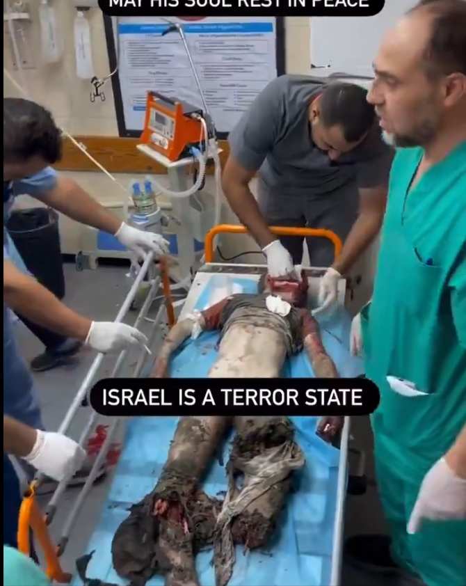 ✅ GAZZEDE SOYKIRIM DEVAM EDİYOR
✅ GAZZEDE AÇLIK DEVAM EDİYOR

✅ GAZZEYİ PAYLAŞMAKTAN ÇEKİNMEYİN
✅ KATİLE KİM DUR DİYECEK

#SONDAKİKA Boykot İstanbul Şaka  Ali Koç Okan İsrail Taksici Hükümet Türk Milleti Bitcoin Iran Turkey Bebek Video Viral Animal Dog Cat Cats War Messi