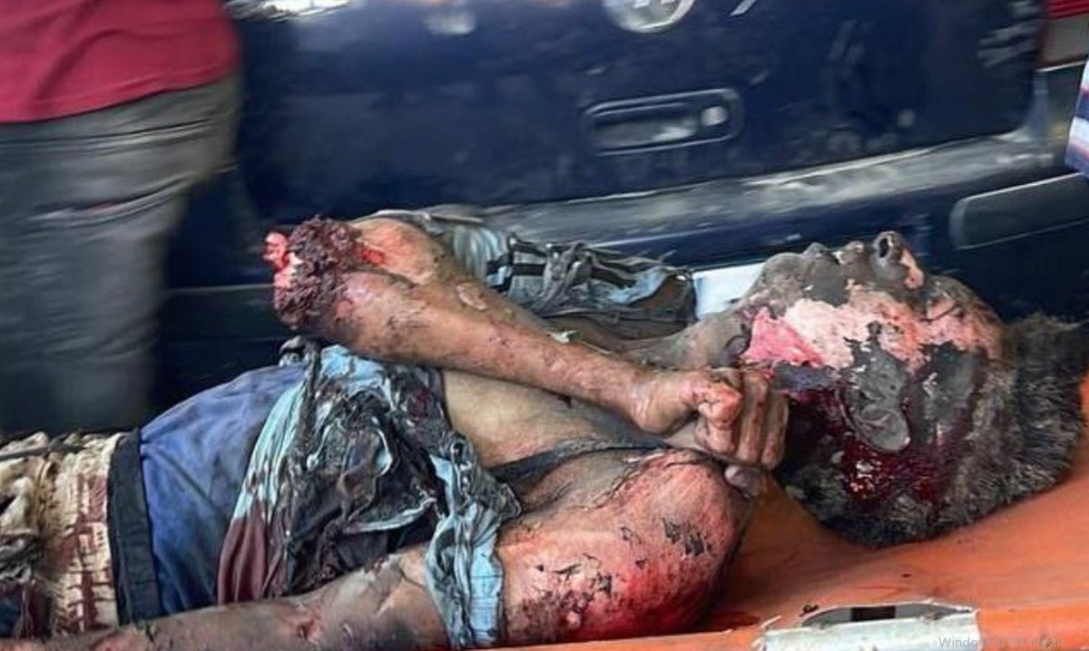 ✅ GAZZEDE SOYKIRIM DEVAM EDİYOR
✅ GAZZEDE AÇLIK DEVAM EDİYOR

✅ GAZZEYİ PAYLAŞMAKTAN ÇEKİNMEYİN
✅ KATİLE KİM DUR DİYECEK

#SONDAKİKA Boykot İstanbul Şaka  Ali Koç Okan İsrail Taksici Hükümet Türk Milleti Bitcoin Iran Turkey Bebek Video Viral Animal Dog Cat Cats War Messi