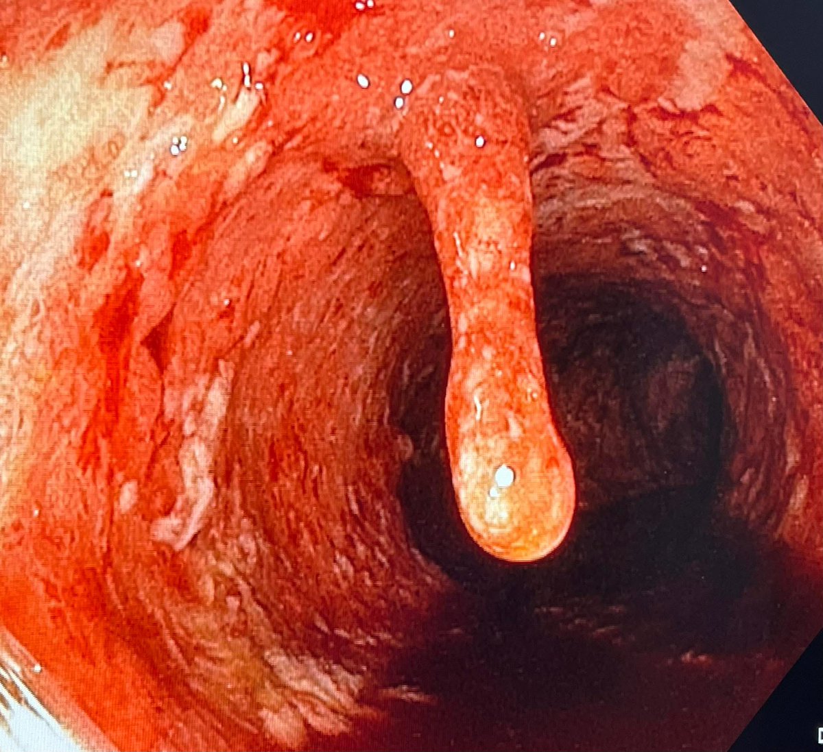 Keith Siau tweet media