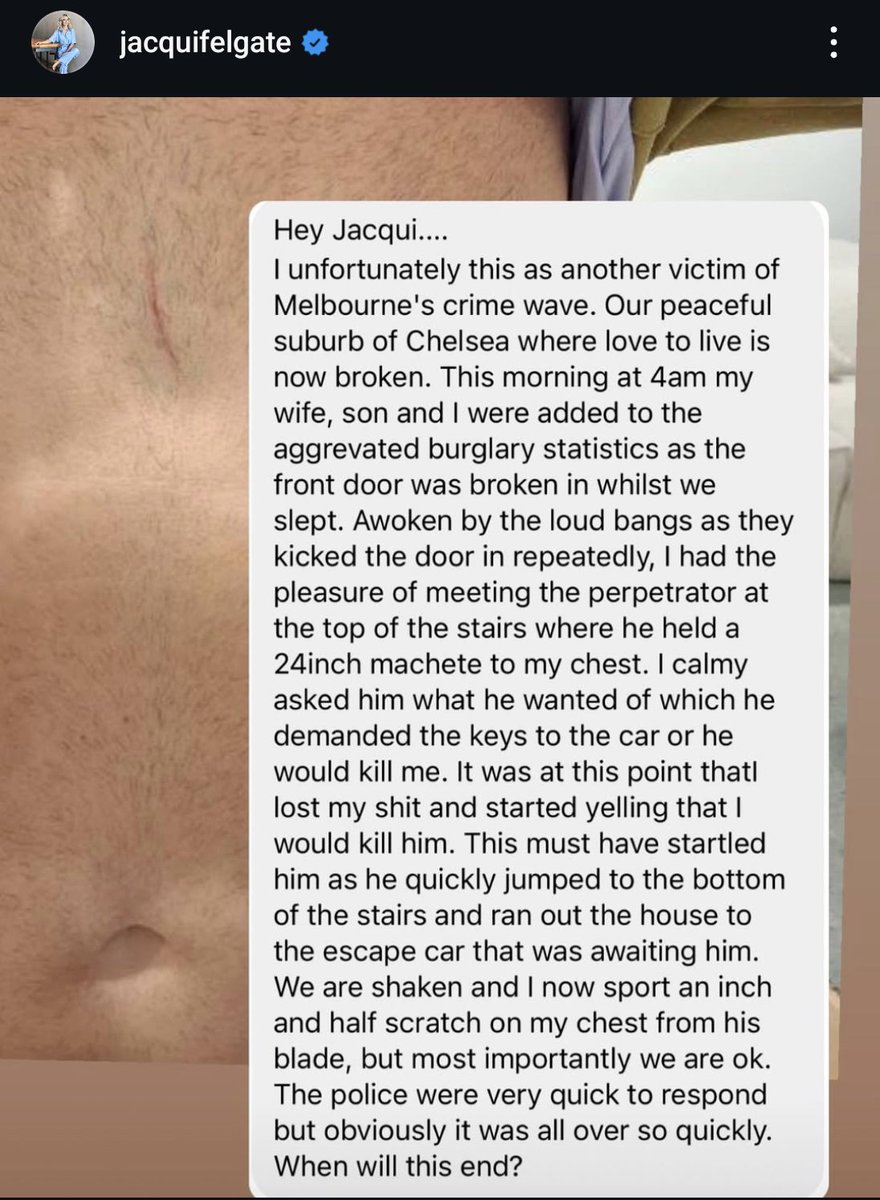 AussieBattl3r's tweet photo. Your constituents in Chelsea dont love becoming victims of aggravated home invasions because of your watered down bail laws.
Victoria is a cesspit of crime and debt because of incompetent @JacintaAllanMP and the ALP.
Medicare ain't saving you from becoming a victim.
#bailfail
#auspol
#vicpol