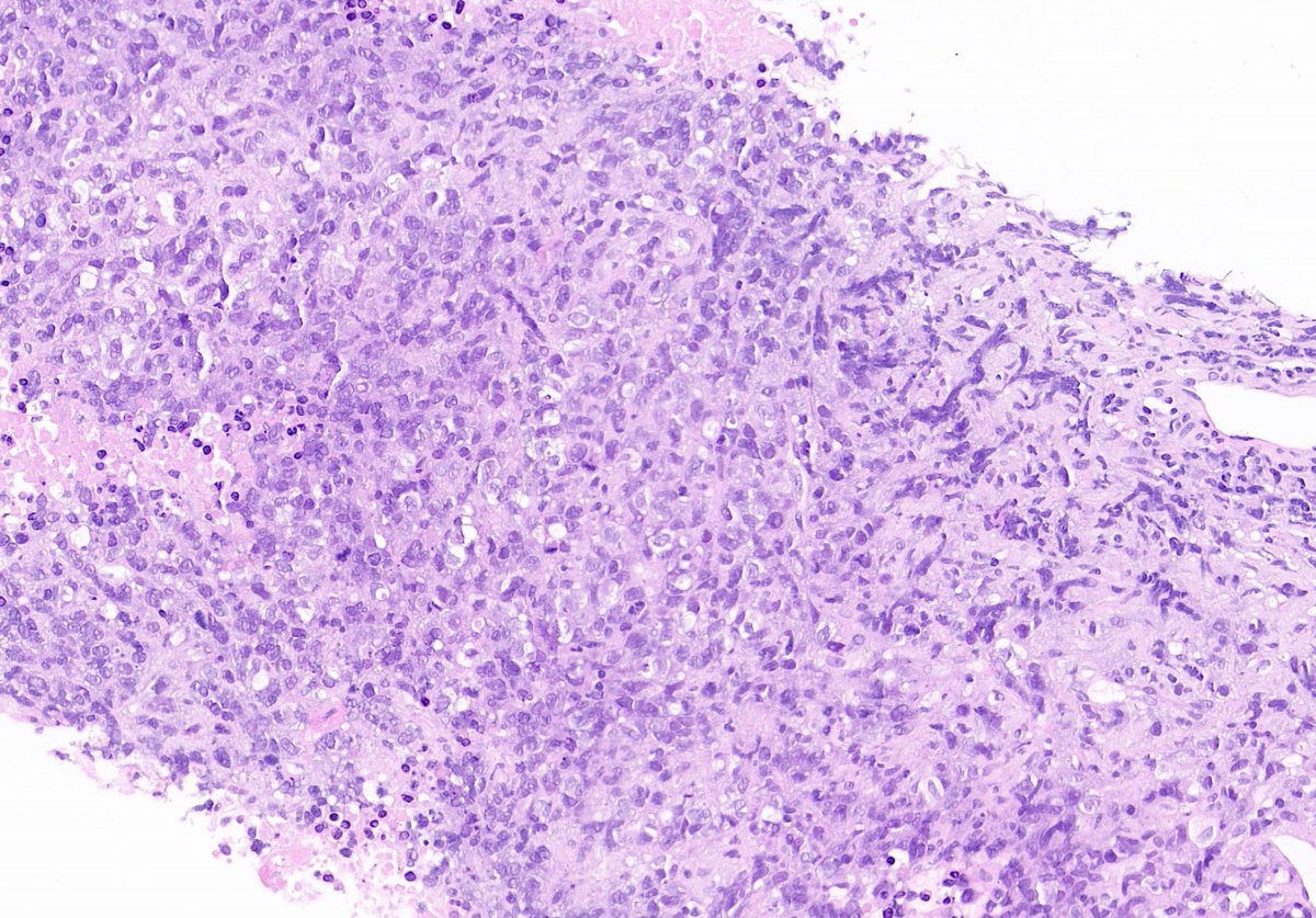 Abdomen, older male

#GIpath #GUpath #BSTpath #pathtwitter #Pathresidents