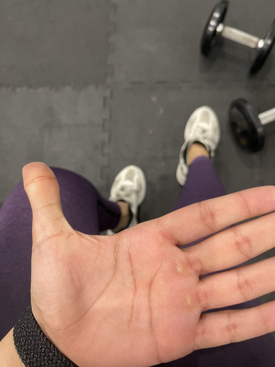 تم القضاء على الظهر والاكتاف💪🏻