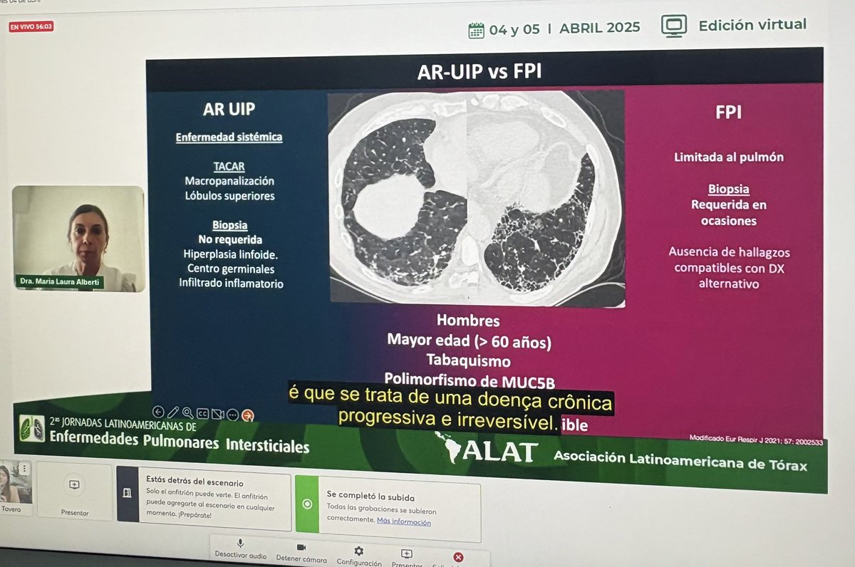 ¡Compartimos con ustedes  el éxito del primer día de las segundas jornadas de actualización en enfermedades pulmonares intersticiales en LATAM, continuamos mañana, acompáñanos!