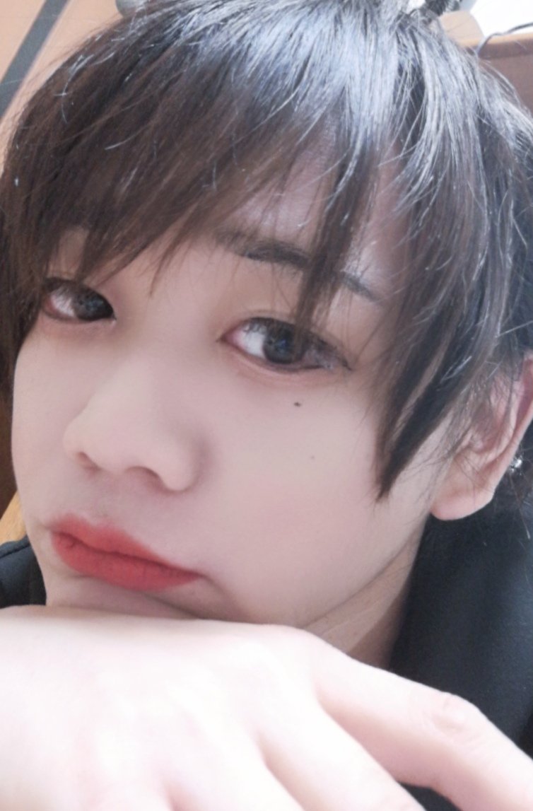 内視鏡手術のため1週間くらい入院します
励まし待ってます笑