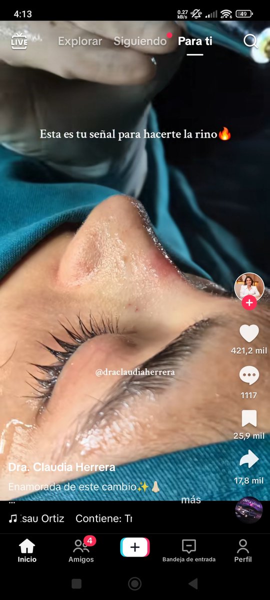 Tiktok flashea cualquiera