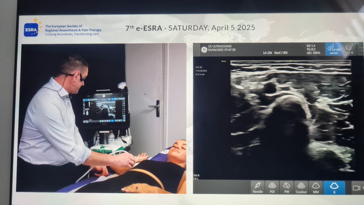 Maite fernandez (@maitefer24) on Twitter photo <a href="/ESRA_Society/">ESRA | European Society of Regional Anaesthesia</a>.#eESRA.fun and useful explanation of EDRA II part. <a href="/ESRA_Society/">ESRA | European Society of Regional Anaesthesia</a>.#eESRA.fun and useful explanation of EDRA II part.