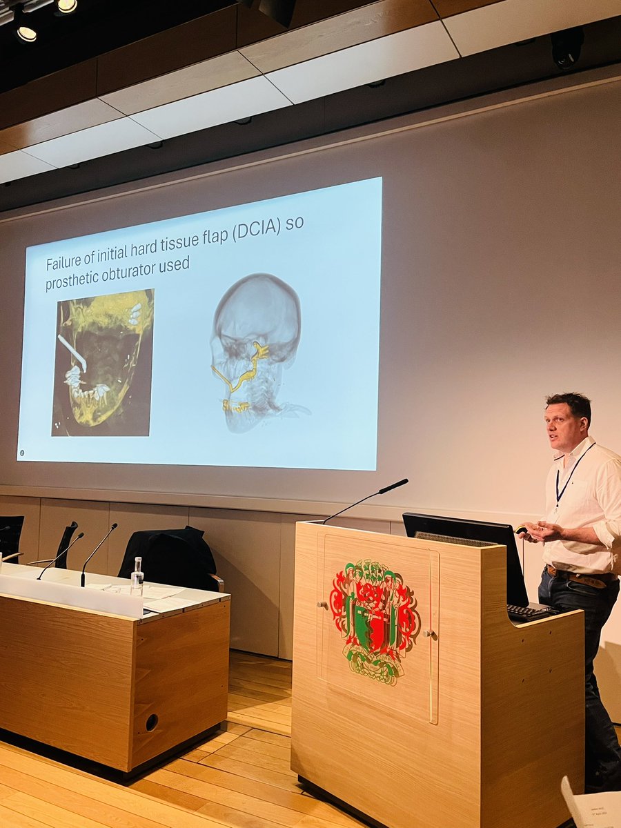 RSM Oral and Maxillofacial Surgery (OMFS) Section (@rsm_omfs) on Twitter photo Head and Neck Maxillofacial Surgery with Mr Goodson <a href="/AlexGoodson11/">Alex Goodson</a> and Mr Henderson <a href="/BAOMSOfficial/">BAOMS</a> <a href="/jtg_baoms/">Junior Trainee Group - BAOMS</a> #UMAX2025 Head and Neck Maxillofacial Surgery with Mr Goodson <a href="/AlexGoodson11/">Alex Goodson</a> and Mr Henderson <a href="/BAOMSOfficial/">BAOMS</a> <a href="/jtg_baoms/">Junior Trainee Group - BAOMS</a> #UMAX2025