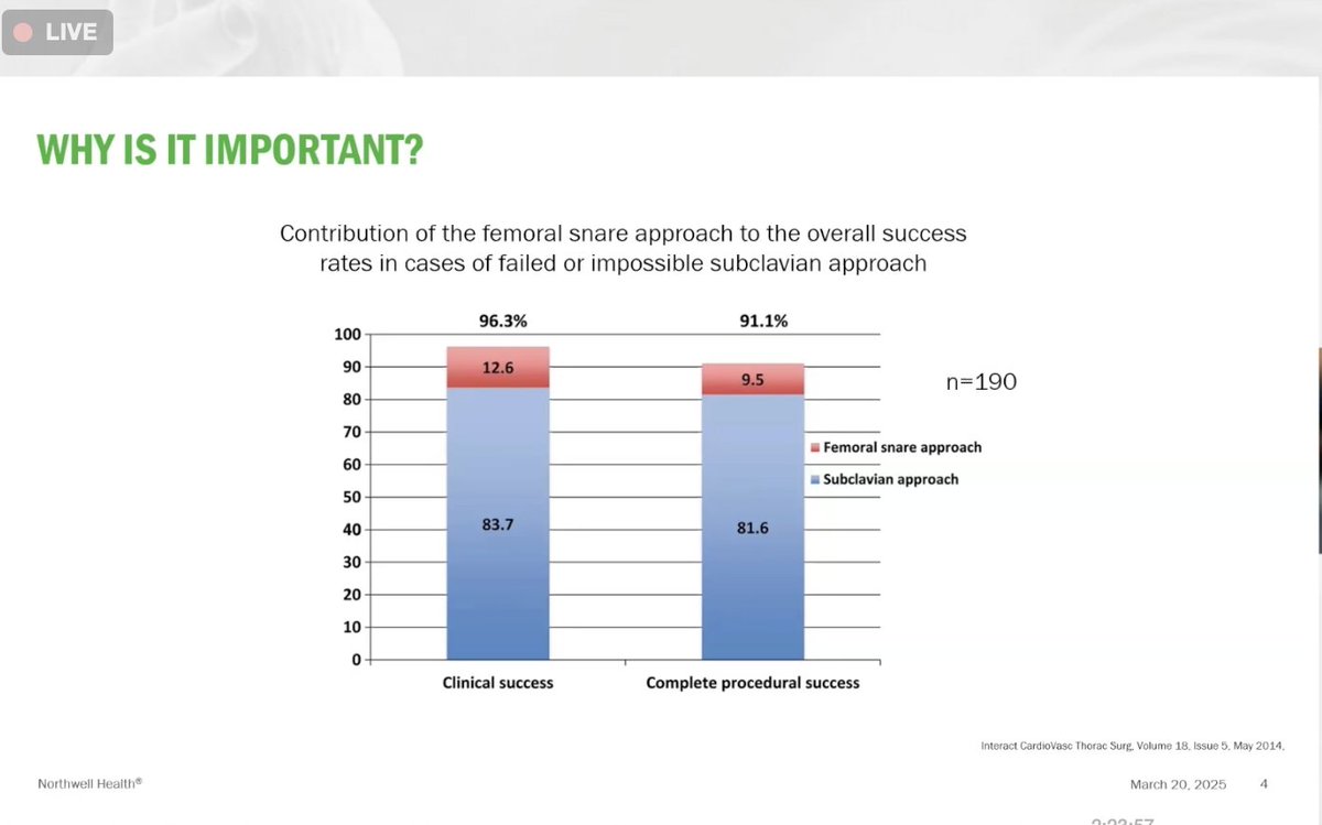 Edward J Schloss MD (@ejsmd) on Twitter photo .<a href="/hisbundle/">Moussa Saleh</a> --
Adding femoral approach to superior approach increases success rate of extraction
#TALES2025
#EPeeps .<a href="/hisbundle/">Moussa Saleh</a> --
Adding femoral approach to superior approach increases success rate of extraction
#TALES2025
#EPeeps