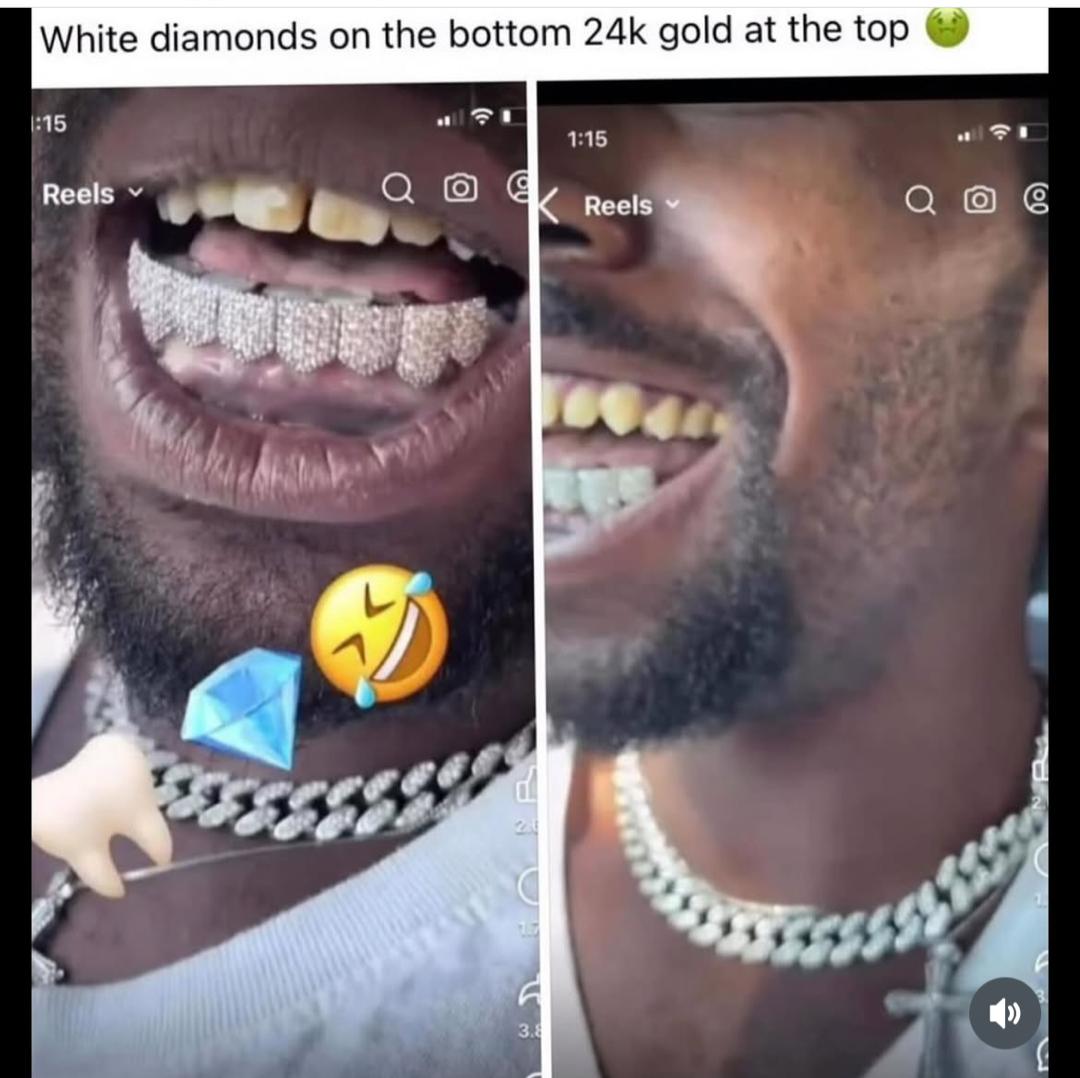 I wan laugh 🤣 but my diamond and gold teeth no gree me 😭💔🤣