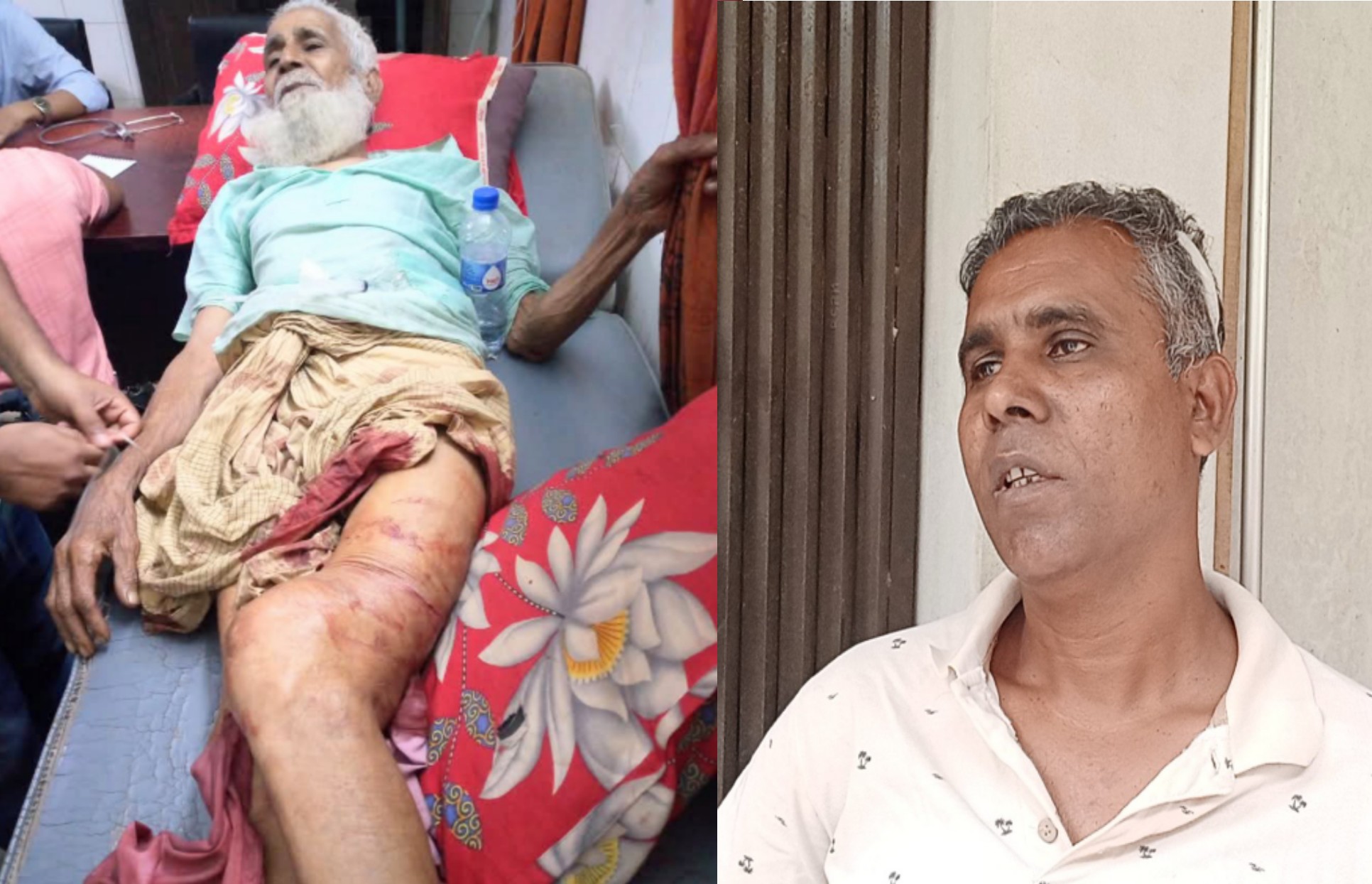 সরিষাবাড়ীতে বৃদ্ধ বাবাকে পিটিয়ে পা ভেঙে পঙ্গু করে দিলো ছেলে