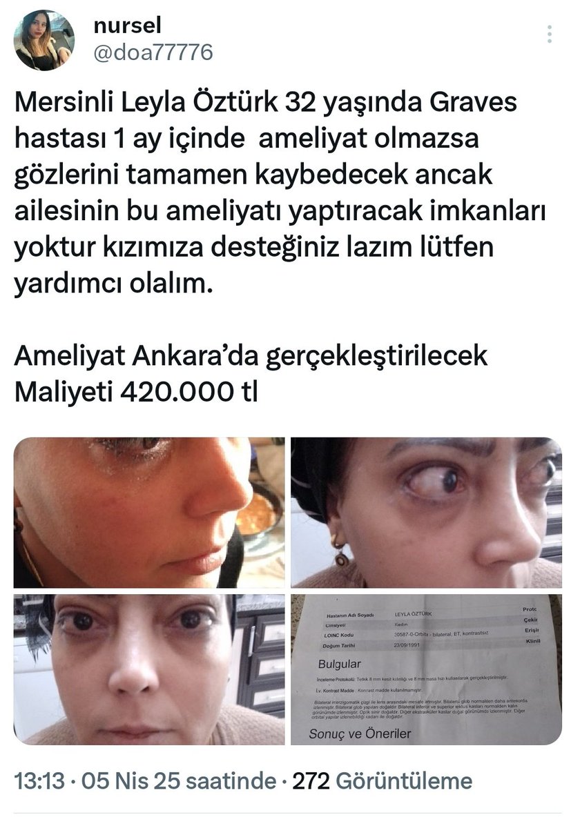 2 tane acil ameliyat olması gereken hastamız var.

2 kardeşimizin toplam ameliyat ücreti 
570.000 TL.

Bir kişinin altından kalkabileceği rakamlar değil.

Büyük kitlelere ulaşmamız gerekli.