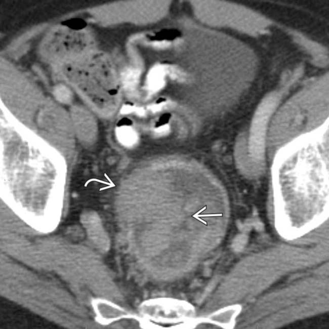 Our case of the month for April is unusual

During a long procedure a second segment of bowel was removed, but this was left inside the abdomen

Surgeon only realised while driving home. 

A long case, limited breaks &amp; other factors discussed

Read here
👇
coress.org.uk/case-of-the-mo…