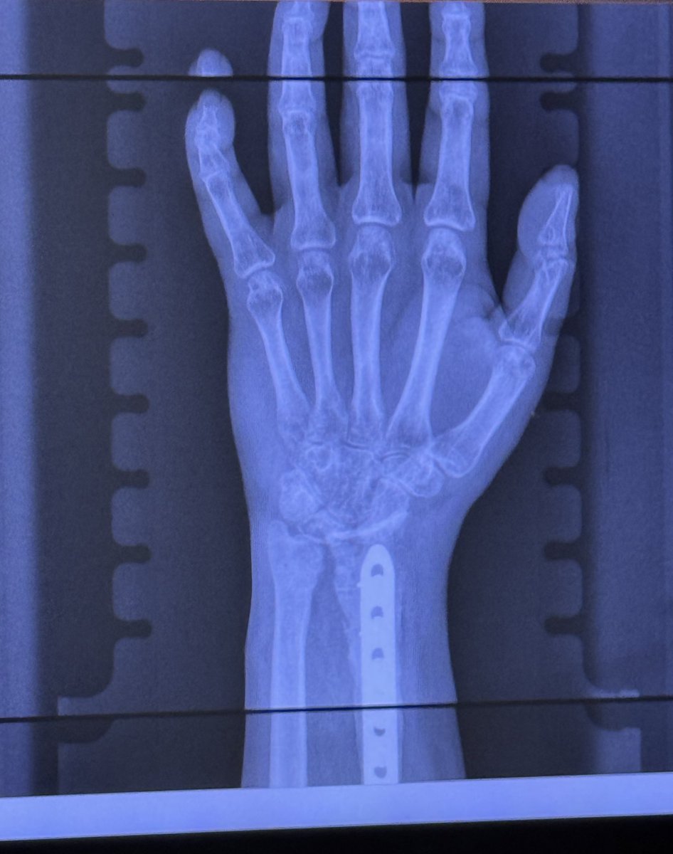 UNCLE 🏴‍☠️ EDDIE 🫵😹 tweet media