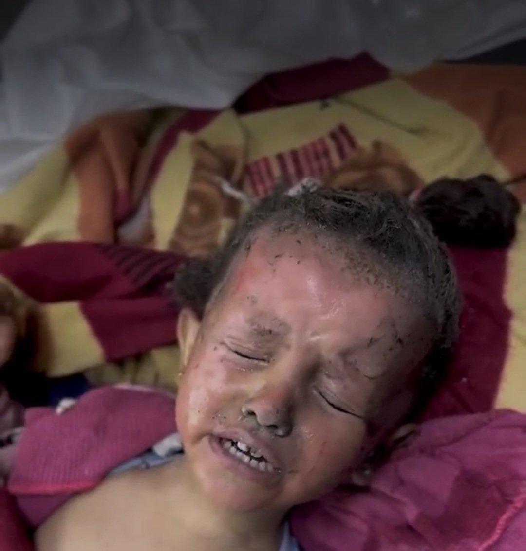 nowgnna's tweet photo. في مشهد يفوق قدرة الكلمات على الوصف، يُذبح أطفال فلسطين في غزة أمام أعين العالم بأكمله، دون أن يُحرّك أحد ساكنًا، وكأن الطفولة هناك بلا حق في الحياة.

انظروا في عيونهم... عيون صغيرة أنهكها الخوف والجوع، وكأنها تسأل: "ماذا فعلنا؟ لماذا يُقتَل البراءة بهذا الشكل؟" https://t.co/9KPPPcxsWw