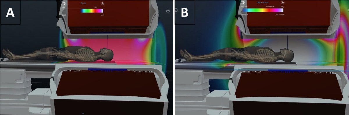 Radiology (@radiology_rsna) on Twitter photo Read on for updates and revisions to the ACR Manual on MR Safety in this article by Pedrosa et al. <a href="/cincykidsrad/">Cincy Kids Radiology</a> <a href="/UCSFImaging/">UCSF Imaging</a> <a href="/therealjonadill/">Jonathan Dillman</a> <a href="/mnhoff/">Michael Hoff</a> bit.ly/3Yg9nj1 Read on for updates and revisions to the ACR Manual on MR Safety in this article by Pedrosa et al. <a href="/cincykidsrad/">Cincy Kids Radiology</a> <a href="/UCSFImaging/">UCSF Imaging</a> <a href="/therealjonadill/">Jonathan Dillman</a> <a href="/mnhoff/">Michael Hoff</a> bit.ly/3Yg9nj1