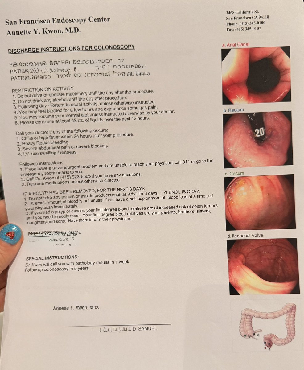 Just had a camera tour through my Colon—6 stars, would recommend.
Easy nap, clean colon, peace of mi