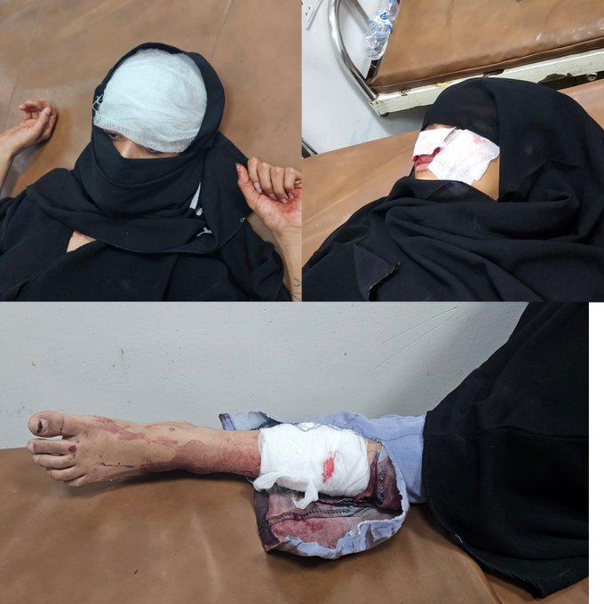 الصورة