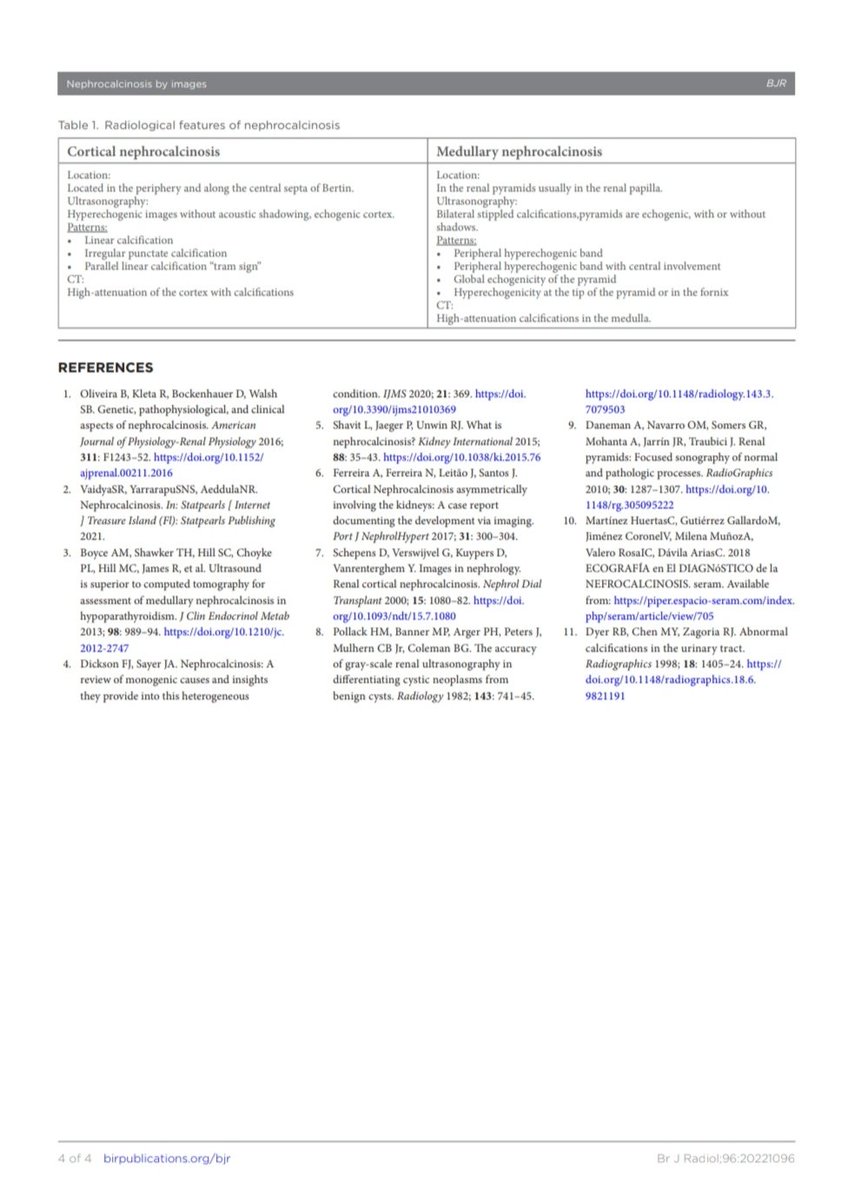 Joaquín Martínez (@jmmr83) on Twitter photo Imagen en nefrocalcinosis
<a href="/NephroP/">NephroPOCUS</a> <a href="/OswaldoRamosN/">Dr. Oswaldo Ramos</a> <a href="/drPowerDoppler/">DrDopplerPoder</a> <a href="/javiteigell/">Javier Teigell</a> <a href="/y_interna/">Medicina Interna. Lo miro y mañana te digo.</a> <a href="/yaletung/">Yale Tung-Chen</a> <a href="/SonoSamMD/">Samuel García Rubio</a> <a href="/curromir/">Curro Miralles</a> <a href="/zbriote/">José António Briote Mariz</a> <a href="/ABCDEcografia/">ABCDEcografía</a> <a href="/PierpaDiNick/">Pierpaolo Di Nicolò</a> <a href="/jpalacinp/">Jose Maria Palacin</a> <a href="/jorgezzb/">Jorge Zegarra</a> <a href="/AlvarezHigueras/">Fco. Javier Alvarez Higueras</a> <a href="/ignaciomsb/">Ignacio M Sánchez 🇪🇦🇪🇺🇺🇦🎸</a> <a href="/mberchid/">M. Solimán Berchíd Debdi</a> <a href="/EcosemfyC/">EcosemFYC</a> <a href="/USPed_Latam/">USPed</a> <a href="/GTECOSEMI/">GT Ecografía SEMI</a> Imagen en nefrocalcinosis
<a href="/NephroP/">NephroPOCUS</a> <a href="/OswaldoRamosN/">Dr. Oswaldo Ramos</a> <a href="/drPowerDoppler/">DrDopplerPoder</a> <a href="/javiteigell/">Javier Teigell</a> <a href="/y_interna/">Medicina Interna. Lo miro y mañana te digo.</a> <a href="/yaletung/">Yale Tung-Chen</a> <a href="/SonoSamMD/">Samuel García Rubio</a> <a href="/curromir/">Curro Miralles</a> <a href="/zbriote/">José António Briote Mariz</a> <a href="/ABCDEcografia/">ABCDEcografía</a> <a href="/PierpaDiNick/">Pierpaolo Di Nicolò</a> <a href="/jpalacinp/">Jose Maria Palacin</a> <a href="/jorgezzb/">Jorge Zegarra</a> <a href="/AlvarezHigueras/">Fco. Javier Alvarez Higueras</a> <a href="/ignaciomsb/">Ignacio M Sánchez 🇪🇦🇪🇺🇺🇦🎸</a> <a href="/mberchid/">M. Solimán Berchíd Debdi</a> <a href="/EcosemfyC/">EcosemFYC</a> <a href="/USPed_Latam/">USPed</a> <a href="/GTECOSEMI/">GT Ecografía SEMI</a>