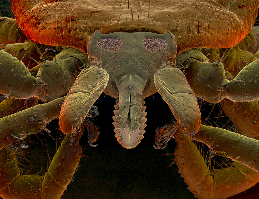 Science Translational Medicine (@sciencetm) on Twitter photo How does anti-tick immunity work?
Scientists create a rapid antigen monitoring platform (IscREAM) and profile immune responses to #Iscapularis #tick cement proteins in humans, providing a resource for future anti-tick vaccines. <a href="/TMHartBio/">Thomas Hart</a> <a href="/JohnsHopkinsMMI/">Molecular Microbiology and Immunology at JHSPH</a> scim.ag/4l8u9uO How does anti-tick immunity work?
Scientists create a rapid antigen monitoring platform (IscREAM) and profile immune responses to #Iscapularis #tick cement proteins in humans, providing a resource for future anti-tick vaccines. <a href="/TMHartBio/">Thomas Hart</a> <a href="/JohnsHopkinsMMI/">Molecular Microbiology and Immunology at JHSPH</a> scim.ag/4l8u9uO
