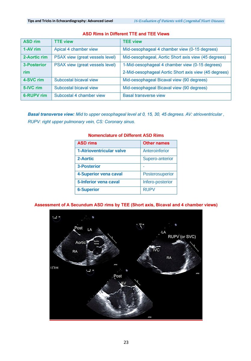 When performing an echocardiogram on a patient with an ASD,  
it's essential to evaluate the rims to determine eligibility for percutaneous closure.  
 Check the different ASD rims  from my book 
"Tips and Tricks in Echo"
Contact me if you're interested in getting a copy