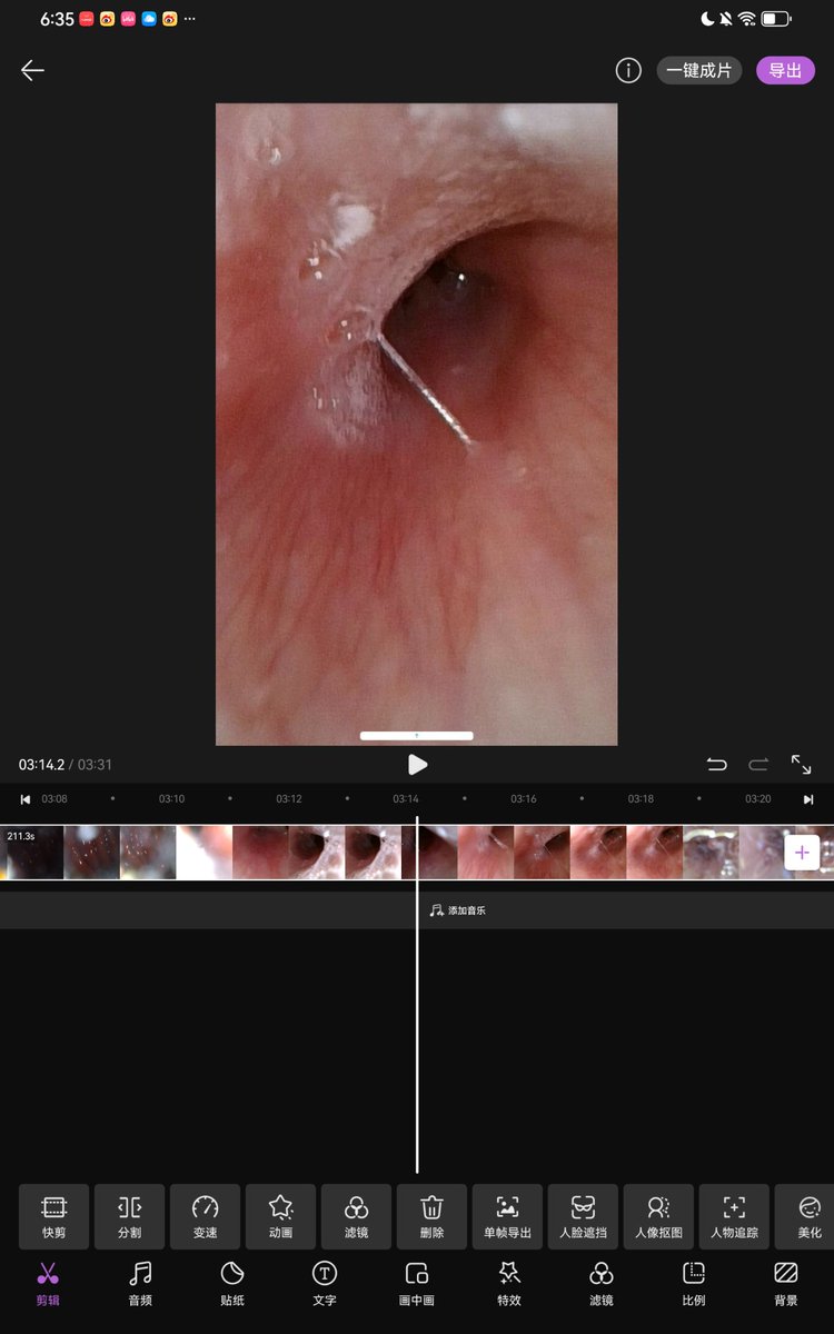 YY2365148's tweet photo. #vomit #bigbelly #puke #嘔吐 #嘔吐物 #大食い #膨腹 #吞 #vore #內窥 #內窺 #endoscopy #vore #gtst https://t.co/goKF90z7hH