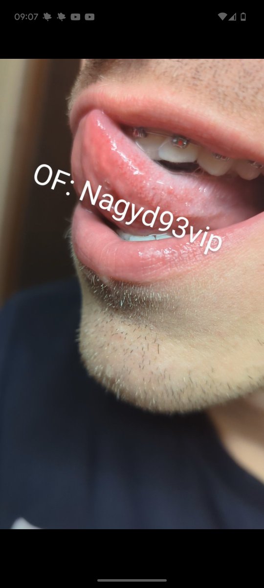 Would you mind if I had braces? 

onlyfans.com/nagyd93vip
