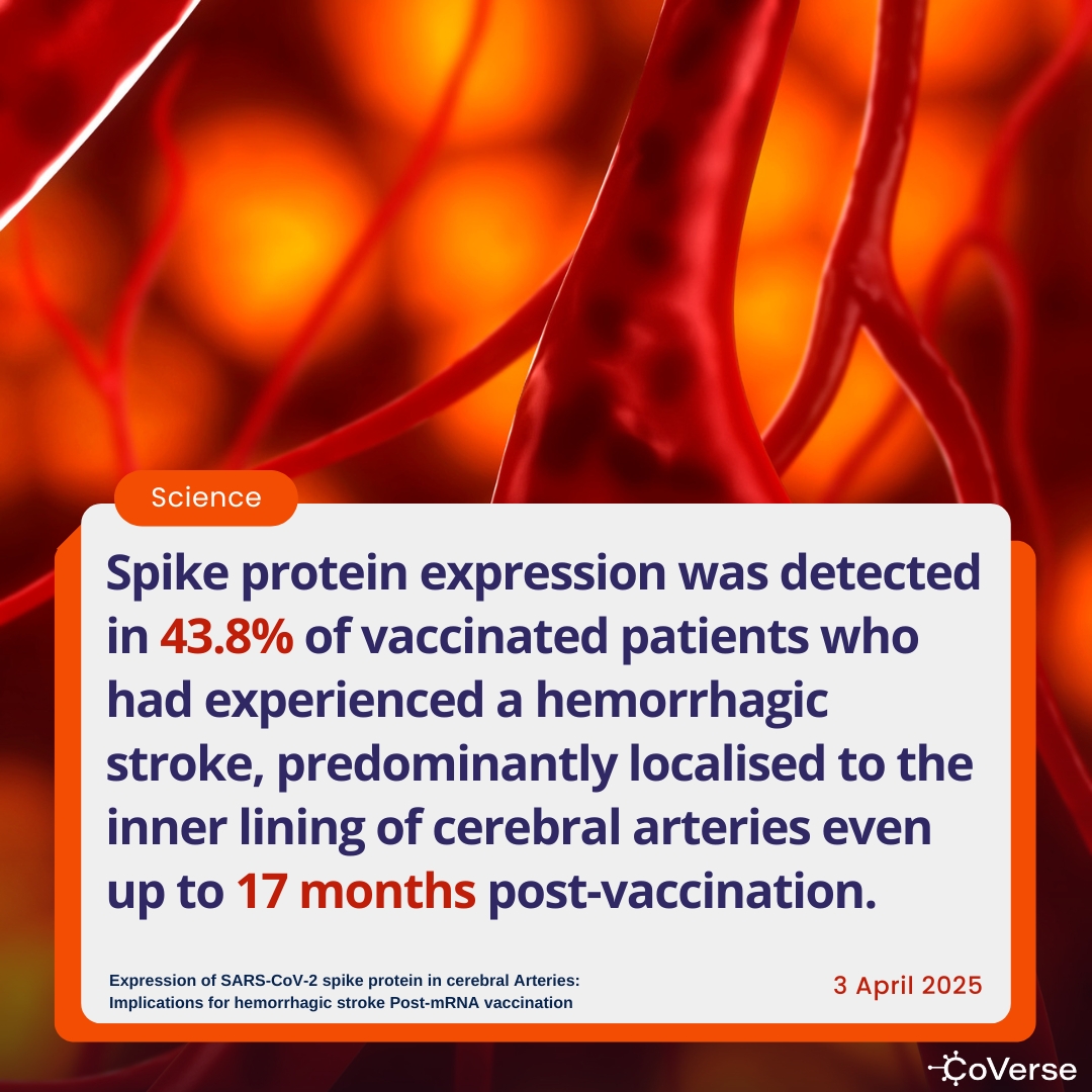 A peer-reviewed study in the Journal of Clinical Neuroscience found vaccine-induced spike protein in the cerebral arteries of 43.8% of vaccinated individuals who had experienced a hemorrhagic stroke — still detectable up to 17 months later. This study raises critical questions