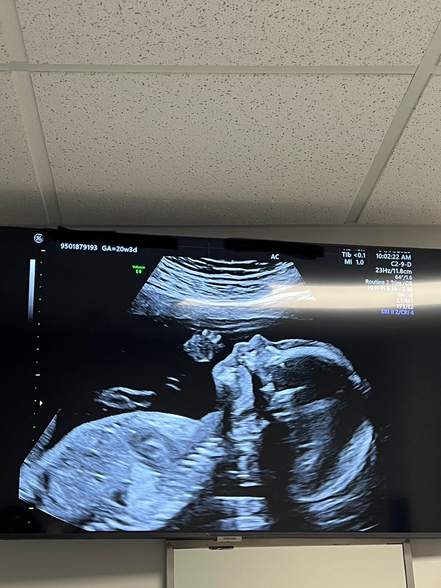 I never got to inform my friends from the gaming side of my life. But I’ll be becoming a dad to a baby boy this coming August. :)