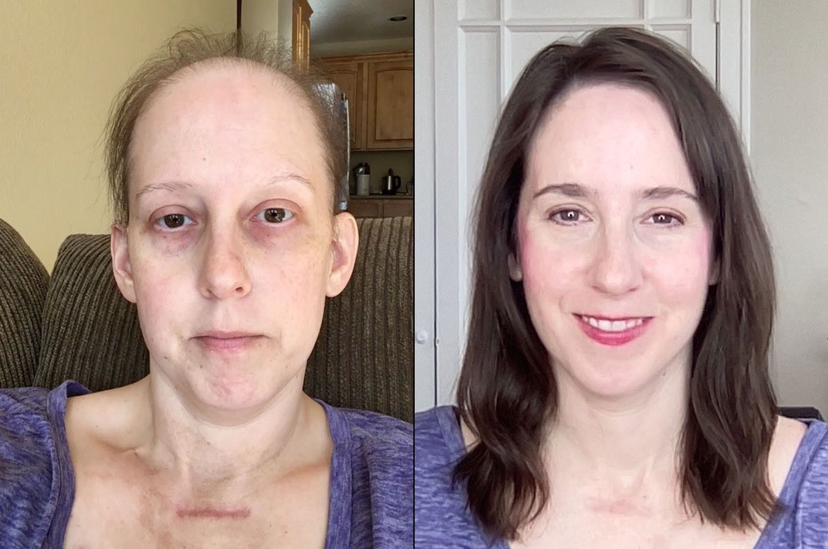 lpackard's tweet image. Eight years ago I was diagnosed with stage 4 cancer. I’m in remission, grateful to still be here, each and every day.