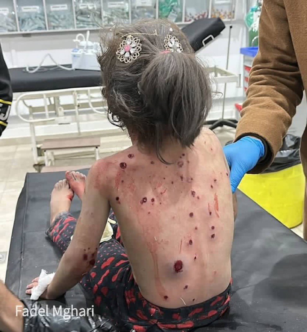 No words.
If you see these little angels, reply with 💔🇵🇸
Don't forget our children 💔